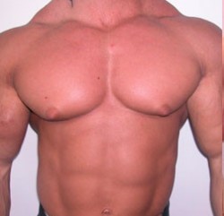 Side effects of steroids 250x241